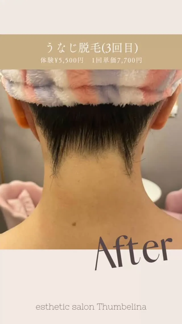 『美しい素肌への最短美容🌹 𝒜ℊℯ 𝟜𝟞 Part98🌟』