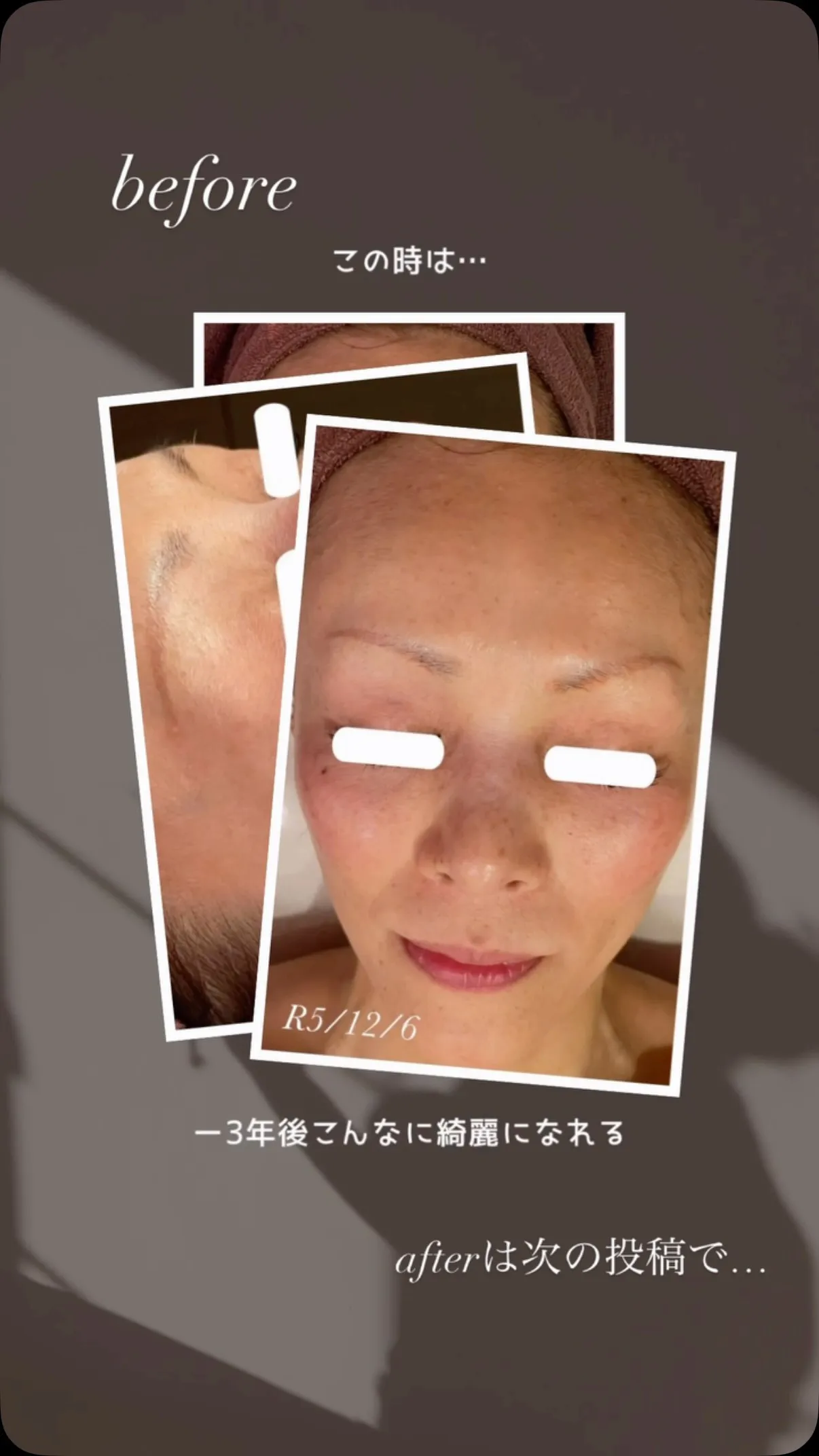 肌本来の美しさを取り戻す、第一歩。
